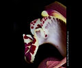 Orchid